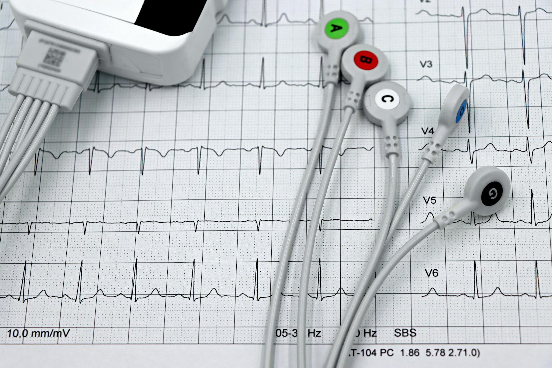 Durée diagnostic électrique : Étapes clés et erreurs à éviter